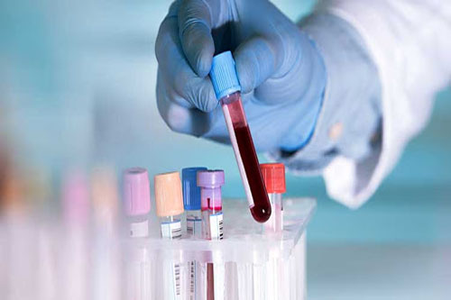 Best Pathology Lab in Shahdol